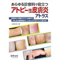 カラ-アトラス小児の湿疹 アトピ-性皮膚炎の外来診療/金原出版/山本一哉（単行本） Amazon.co.jp: カラ-アトラス小児の湿疹: アトピ-性皮膚炎の外来