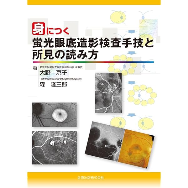 Amazon.co.jp: 蛍光眼底造影ケーススタディ エキスパートはFA・IA  