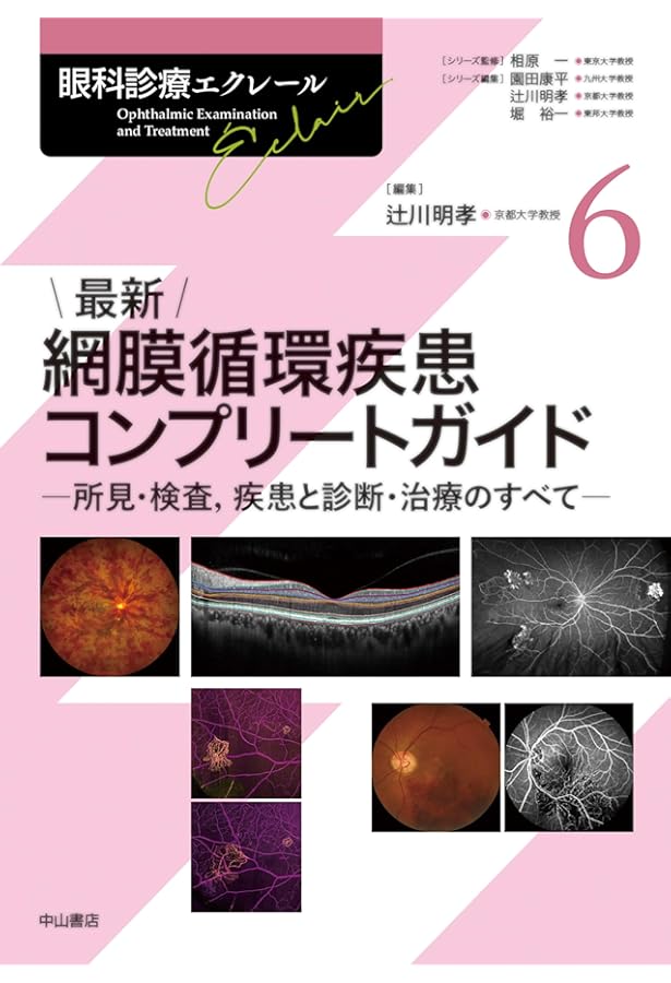 最新 眼科画像診断パワーアップ (眼科診療エクレール 2) | 辻川明孝