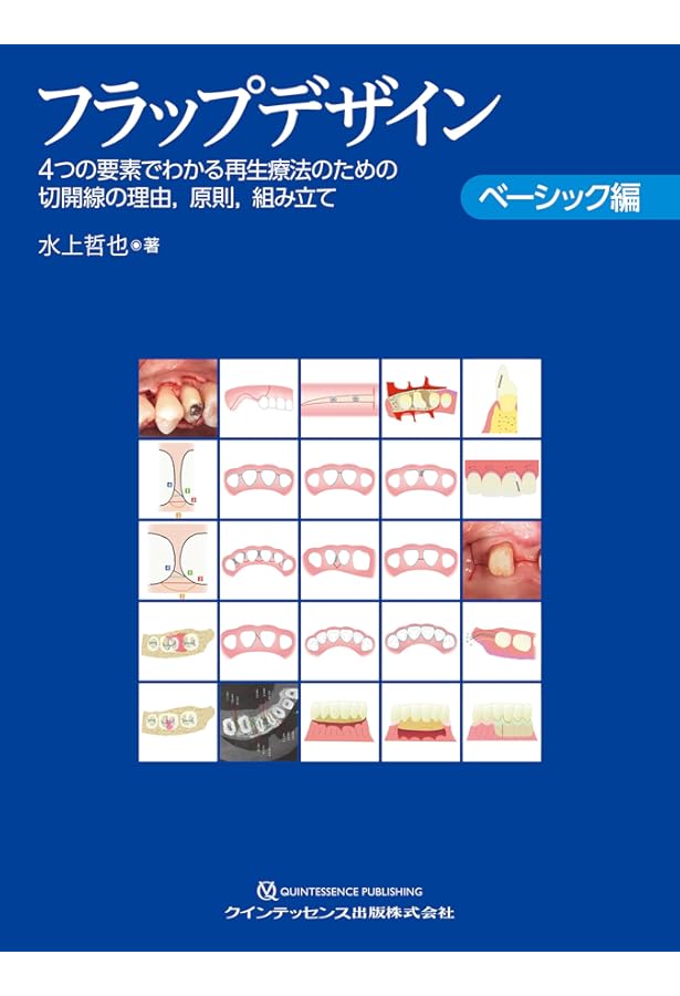 フラップデザイン アドバンス編: 最新のフラップデザインのコンセプト