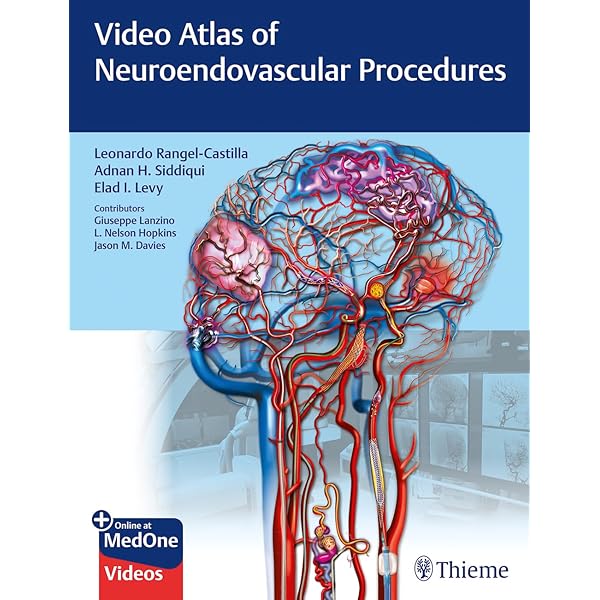 健康・医学 Decision Making in Neurovascular Disease Decision Making in Neurovascular Disease: jetzt bestellen im