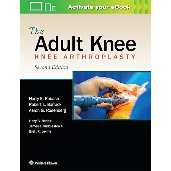 Amazon | The Adult Hip (Two Volume Set): Hip Arthroplasty Surgery 