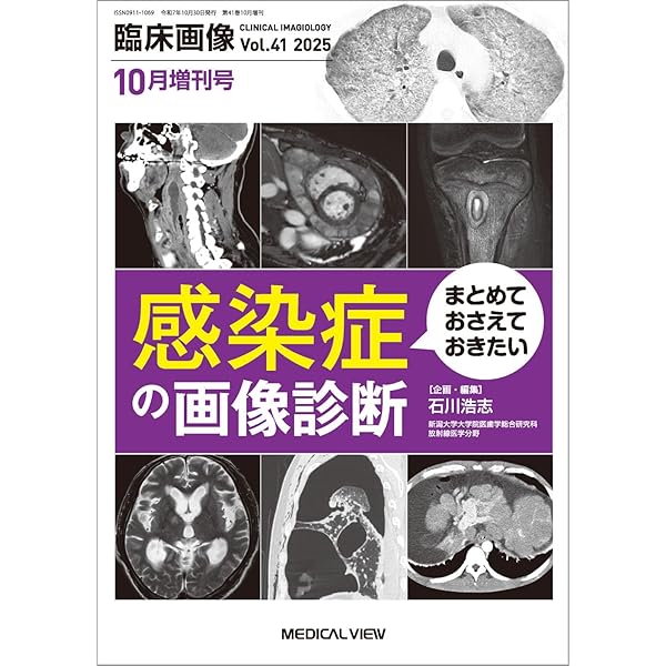 臨床画像 2025年4月増刊号 特集：腹部画像診断における画像と