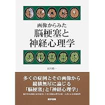 画像からみた 脳梗塞と神経心理学 画像からみた 脳梗塞と神経心理学 | 田川 皓一 |本 | 通販 | Amazon
