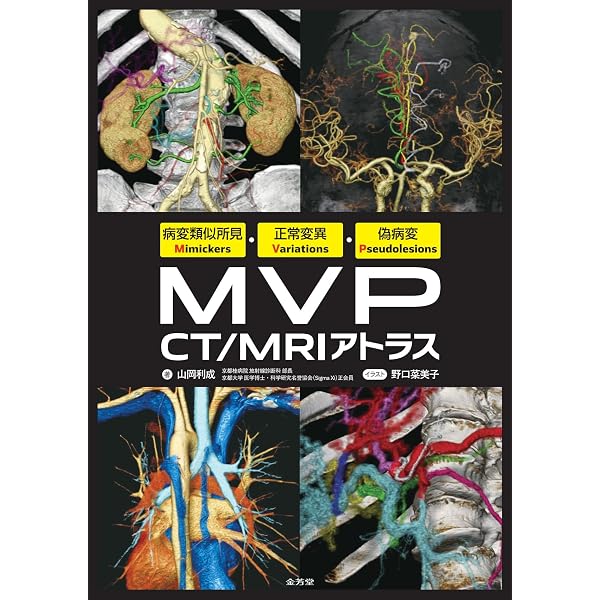 すぐに役立つ胸部CT診断マニュアル | 髙橋雅士 |本 | 通販 | Amazon