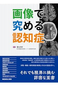 武器としての神経症候・高次脳機能障害の診かた 高次は地味だが
