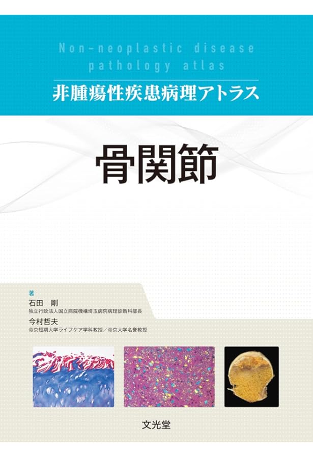 肺 (非腫瘍性疾患病理アトラス) | 蛇澤 晶, 熊坂利夫 |本 | 通販 | Amazon