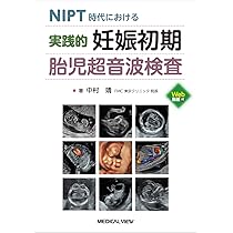 早産のすべて−基礎から臨床，DOHaDまで−改訂第2版 | 大槻 克文