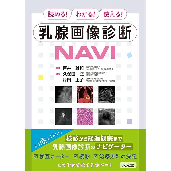 知っておきたい乳房の画像診断 (画像診断別冊KEY BOOKシリーズ