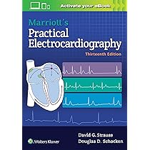 洋書 Chou's Electrocardiography Buy Chou's Electrocardiography in Clinical Practice: Adult and
