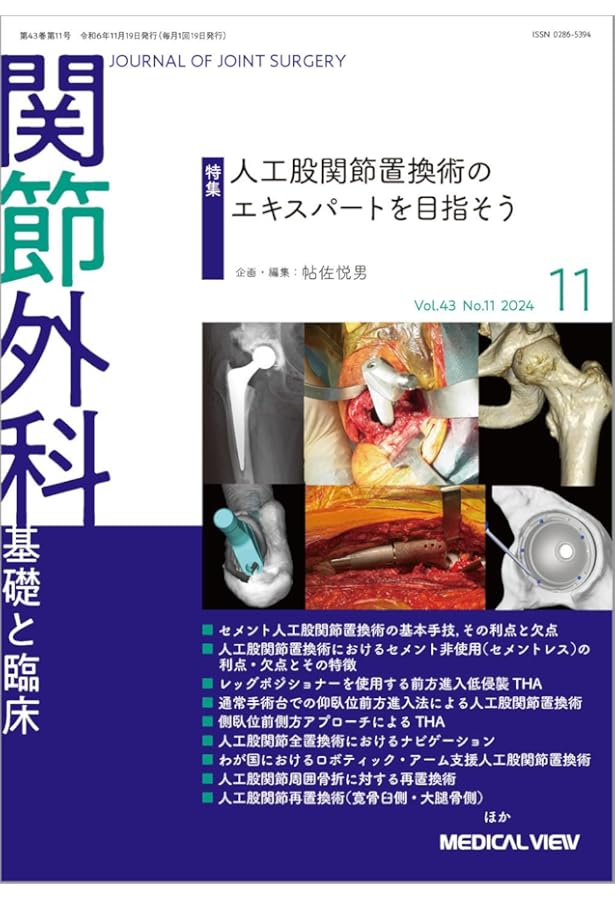 人工股関節全置換術[THA]のすべて | 伊藤 浩 |本 | 通販 | Amazon