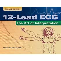 Chou's Electrocardiography in Clinical Practice: Adult and