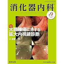 消化器内視鏡34巻2号2022年2月号 胃癌内視鏡診断の最新ムーブメント―H. pylori陰性胃癌のすべて 消化器内視鏡35巻10号2023年10月号 大腸腫瘍に対する外来内視鏡