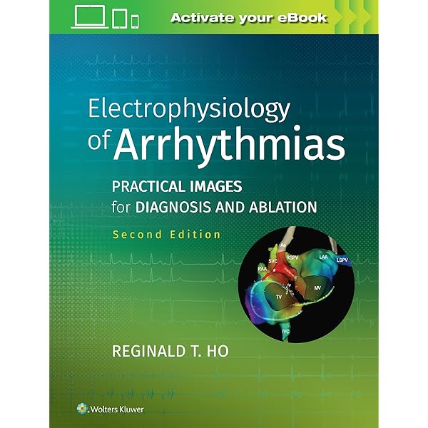 Amazon | Clinical Handbook of Cardiac Electrophysiology