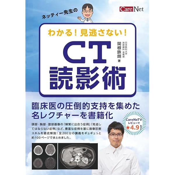 Amazon.co.jp: ネッティー先生のわかる! 見逃さない! CT読影術/ケア