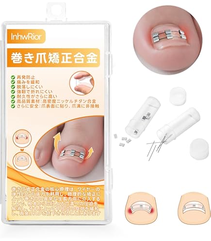 Amazon.co.jp: オニクリップ巻き爪ケア オニクリップ板（厚み0