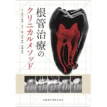 根管治療トラブル攻略本 完全解説 根管治療トラブル攻略本: エンドのよくある24の難局面大攻略