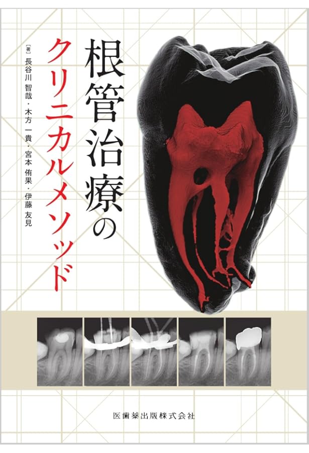 歯界展望別冊 エンド処置歯の支台築造・歯冠修復 歯内療法と補綴の