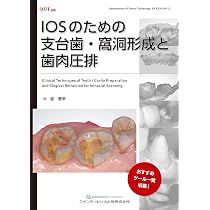 Amazon.co.jp: ビジュアルでわかる 支台歯形成パーフェクトブック