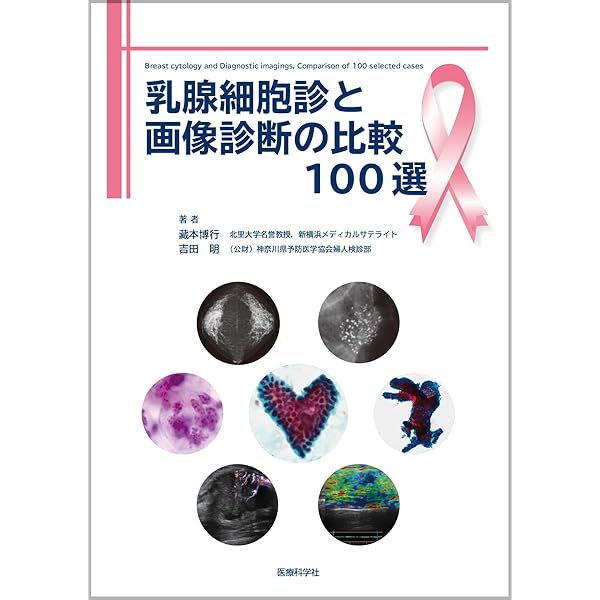 細胞診アトラス 三上芳喜著 細胞診アトラス | 三上芳喜 |本 | 通販 | Amazon