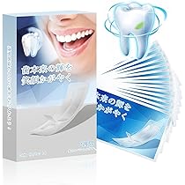 確認ホワイトニング ホワイトニングの診断と治療方法