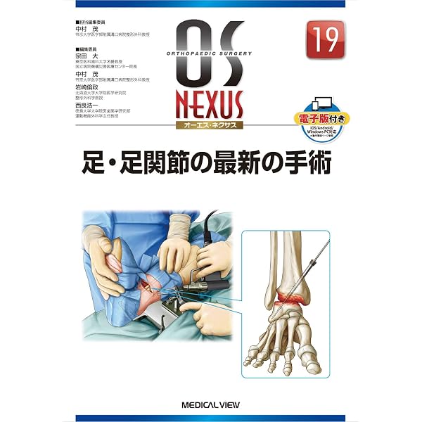手・手関節の骨折・外傷の手術 (OS NEXUS(電子版付き) 3) | 岩崎 倫政 
