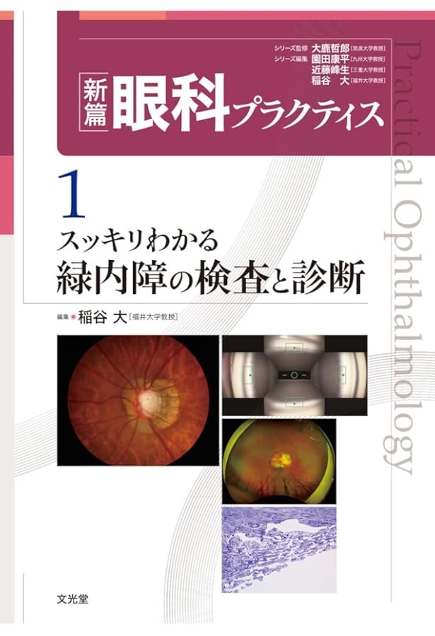 最新 緑内障診療パーフェクトガイドー患者教育から最新の手術治療まで