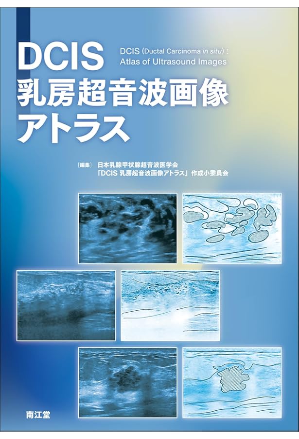 乳房MRIアトラス | 五味 直哉, 菊池 真理, 五味 直哉, 菊池 真理 |本