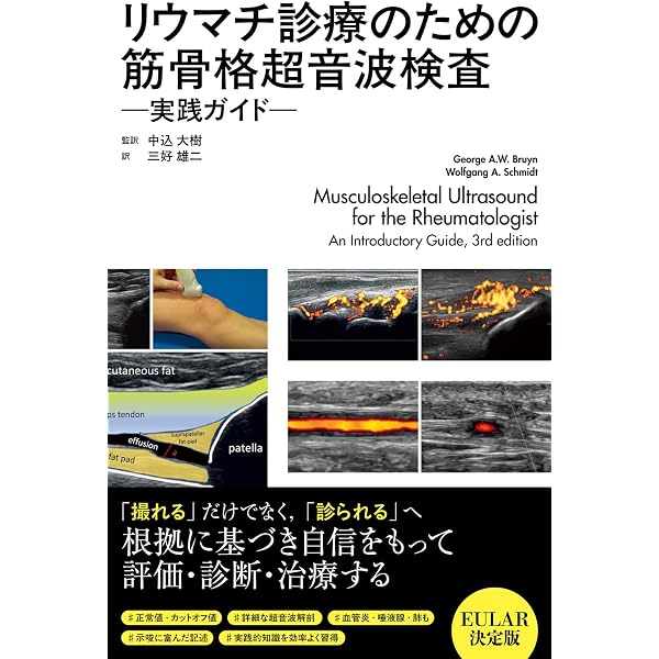 関節リウマチの画像診断 診断の基本から鑑別診断まで 杉本英治; 神島 保 Amazon.co.jp: 関節リウマチの画像診断 診断の基本から鑑別診断まで