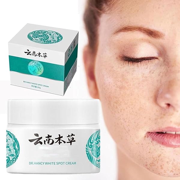 Amazon.co.jp: Dr Hancy White Spot Cream Japan, Japanese Melasma