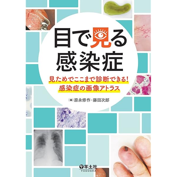 みるトレ 感染症 | 笠原 敬, 忽那賢志, 佐田竜一 |本 | 通販 | Amazon