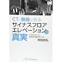サイナスフロアエレベーションアルティメットガイド: 安全確実に上顎洞