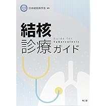 Amazon.co.jp: 結核診療ガイド : 日本結核病学会: 本