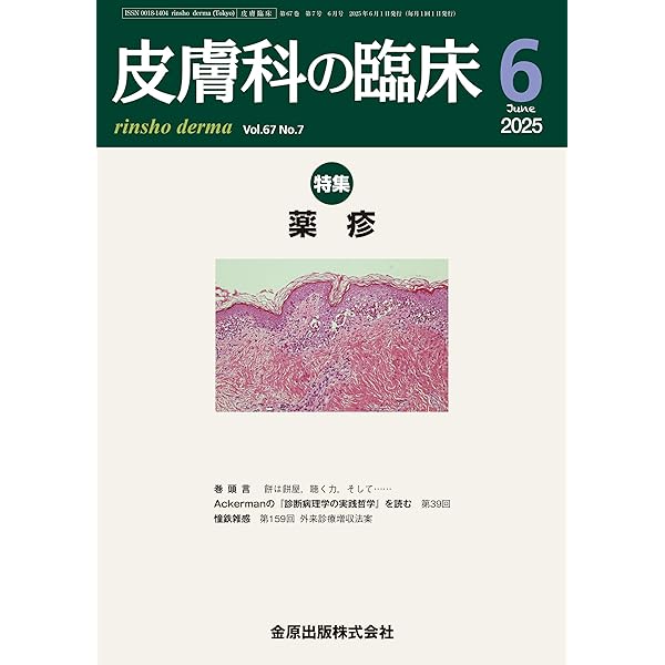 目で見て役立つ 薬疹の上手な診かた・対応ガイド | 阿部 理一郎 |本