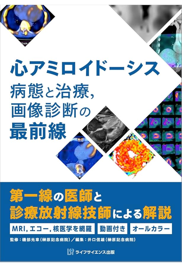 アミロイドーシス診療ガイドライン2025 | 日本アミロイドーシス学会