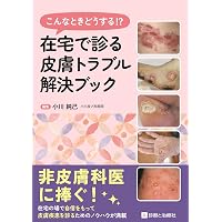 Amazon.co.jp: 好発部位でみる皮膚疾患アトラス 躯幹・四肢: 躯幹