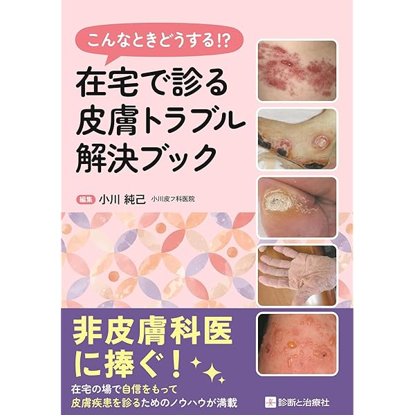 Amazon.co.jp: 好発部位でみる皮膚疾患アトラス 躯幹・四肢: 躯幹