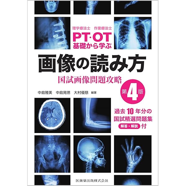 理学療法士・作業療法士 PT・OT基礎から学ぶ 画像の読み方 第3版 国試