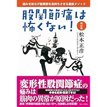 股関節痛は怖くない! 改訂版 (ワニプラス) | 松本 正彦 |本 | 通販