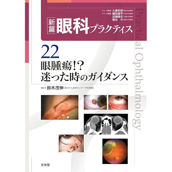 処置室でできる 低侵襲・眼瞼診療 切らない眼科医のアプローチ (新篇