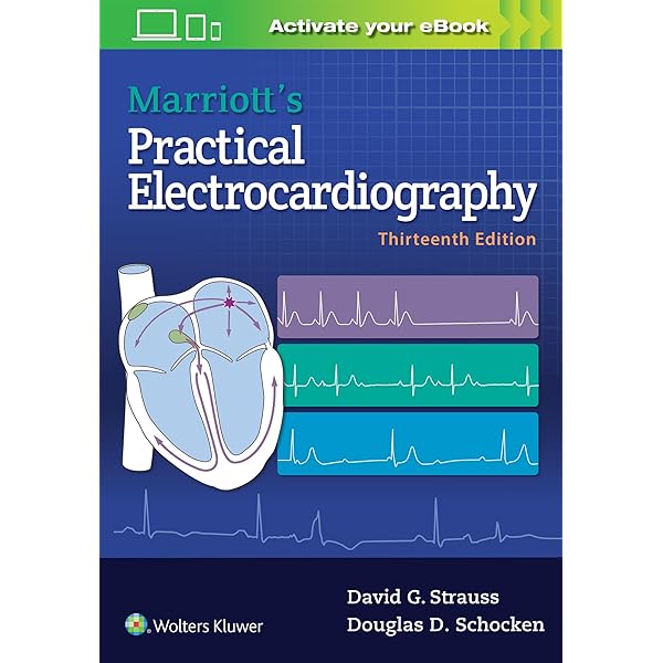 Amazon.co.jp: Chou's Electrocardiography in Clinical Practice