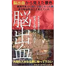 Amazon.co.jp: なぜ、私は脳幹出血と脳梗塞の2重の苦しみを克服できた