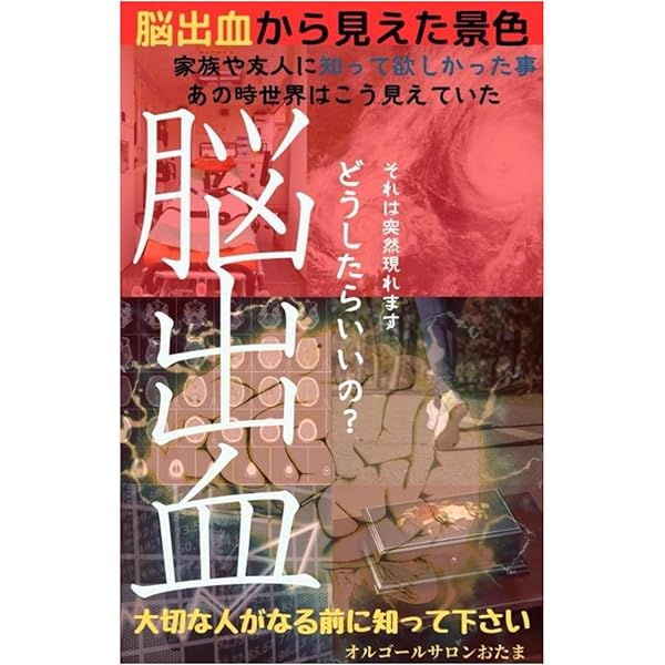Amazon.co.jp: なぜ、私は脳幹出血と脳梗塞の2重の苦しみを克服できた
