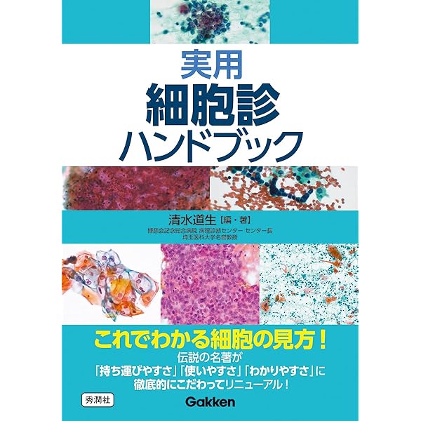 細胞診のすすめ方 ～基礎から学ぶ～ Amazon.co.jp: ~基礎から学ぶ~ 細胞診のすすめ方〈第4版〉 : 西 国広: 本