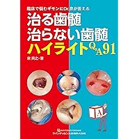 深在性う蝕に対するVital Pulp Therapy: 歯髄保存か抜髄かは患者のため