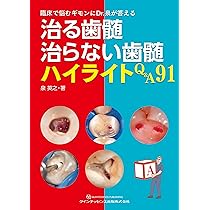 治る歯髄 治らない歯髄 | 泉 英之 |本 | 通販 | Amazon