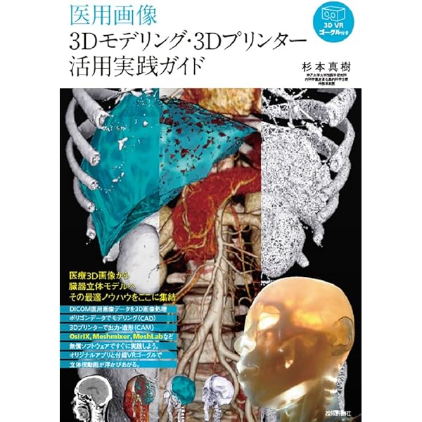 OsiriX画像処理パーフェクトガイド 最新版(Ver.5.9/6.0対応) OsiriX画像処理パーフェクトガイド 最新版(Ver.5.9/6.0対応