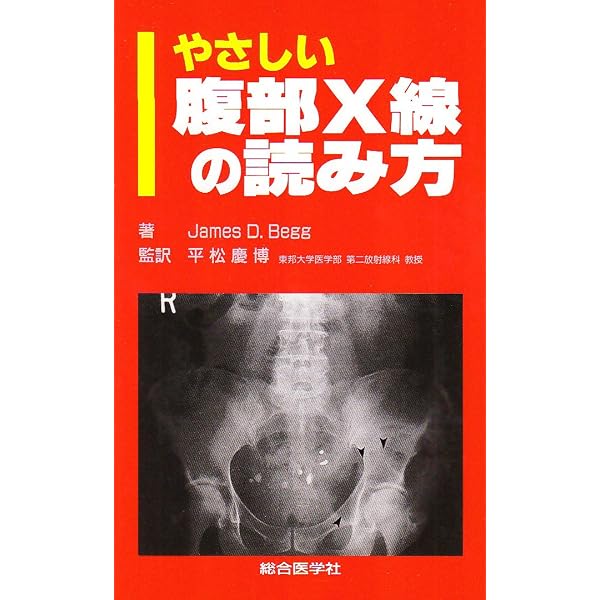 ココまで読める！実践腹部単純X線診断 2版 | 西野 徳之 |本 | 通販
