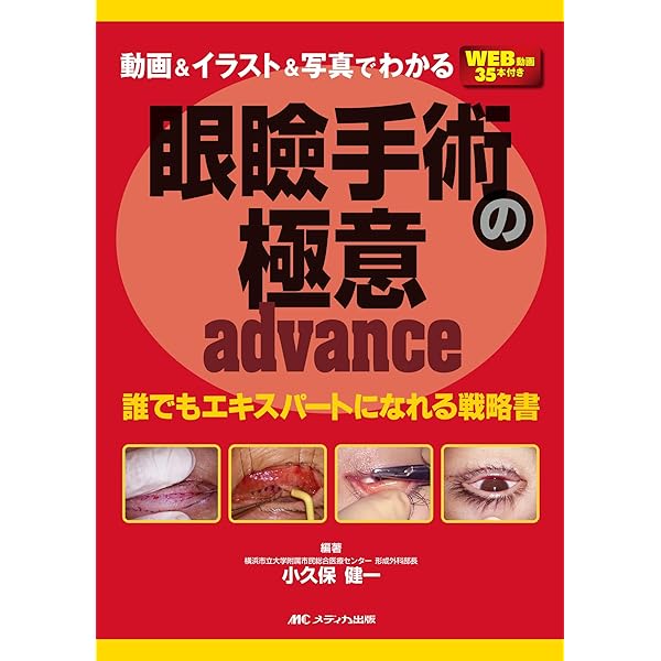 超アトラス眼瞼手術〜眼科形成外科の考えるポイント〜 裁断済み 超  
