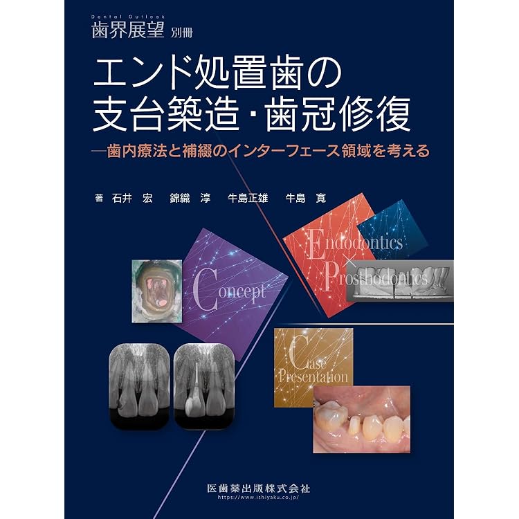 Vital Pulp Therapy 深在性う蝕に対する治療法 深在性う蝕に対するVital Pulp Therapy - クインテッセンス出版